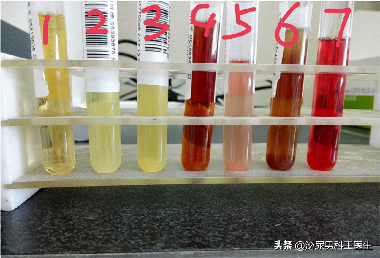 肾好不好，一泡尿就能知晓？若尿液有几种变化，需尽快给肾做检查