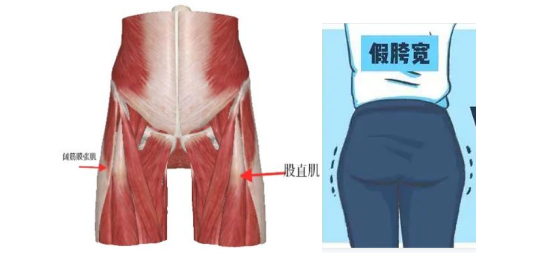 315曝光：6天拿证速成“医师”，产后修复真得小心了