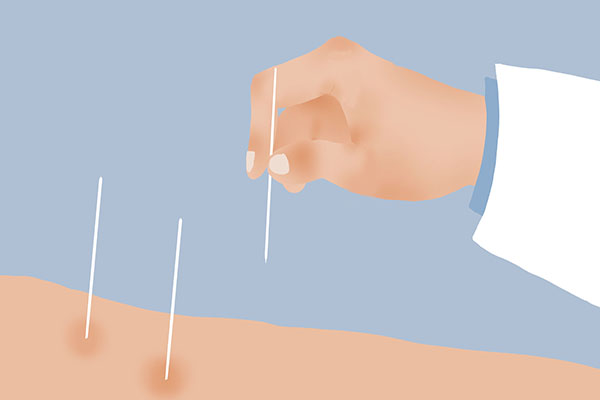 冬季腰背疼痛，如何给脊椎“解冻”？牢记“三多一少”脊背更健康