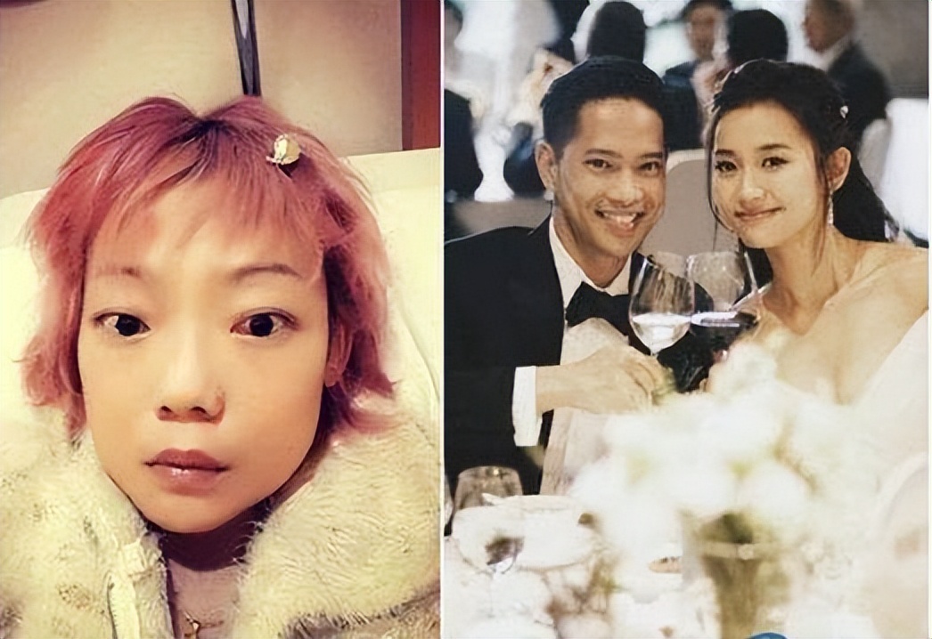 瘦到病态、整容成瘾，痴迷于少女人设，内娱的畸形审美太可怕