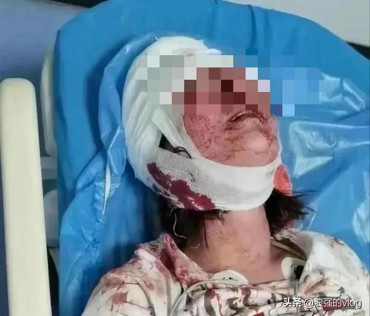 唐山被打的女孩情況不樂觀，可并非流傳的那么恐怖，究竟誰在搞鬼