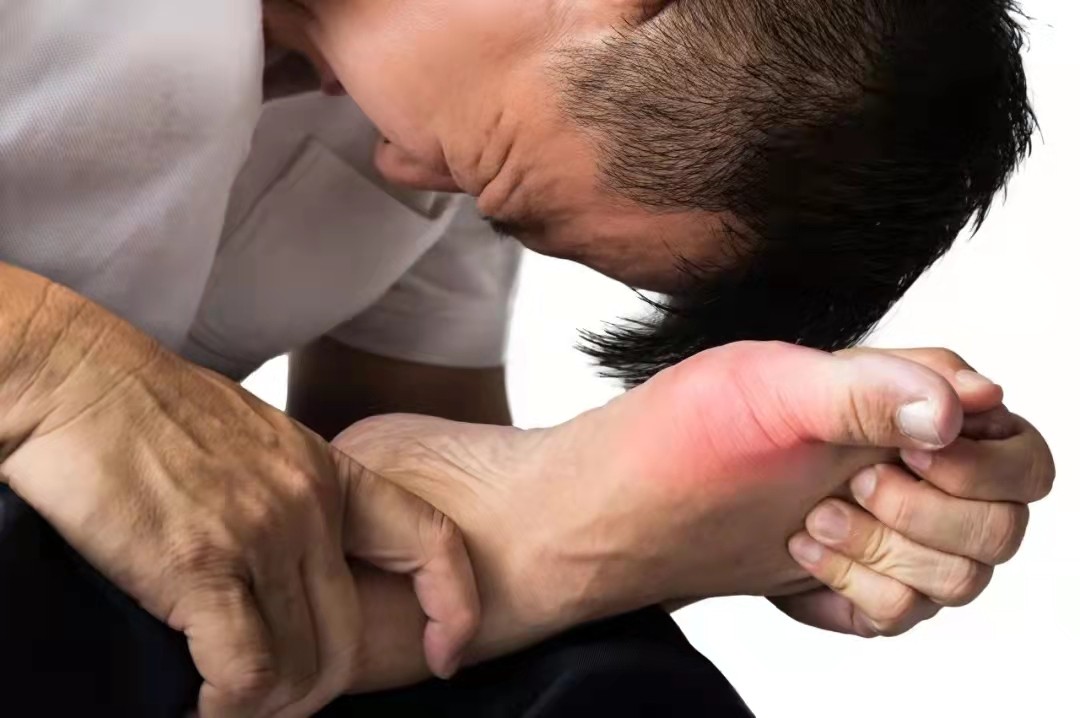 尿酸高了就一定会得痛风吗？来看看“尿酸”那些事