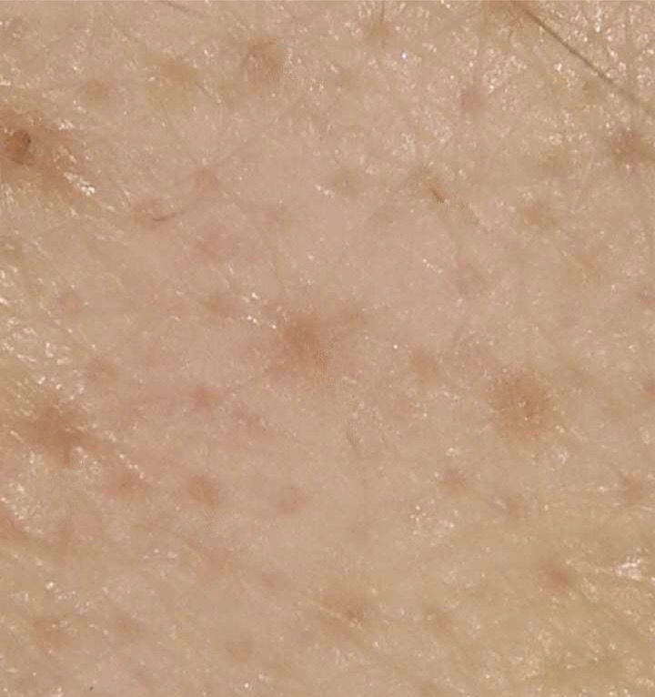 為什么上完粉底液以后，鼻子上有很多白點(diǎn)點(diǎn)？