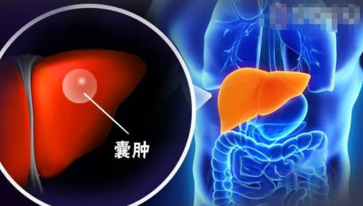 体检查出6种病，听起来可怕，其实基本不用治，别自己吓自己