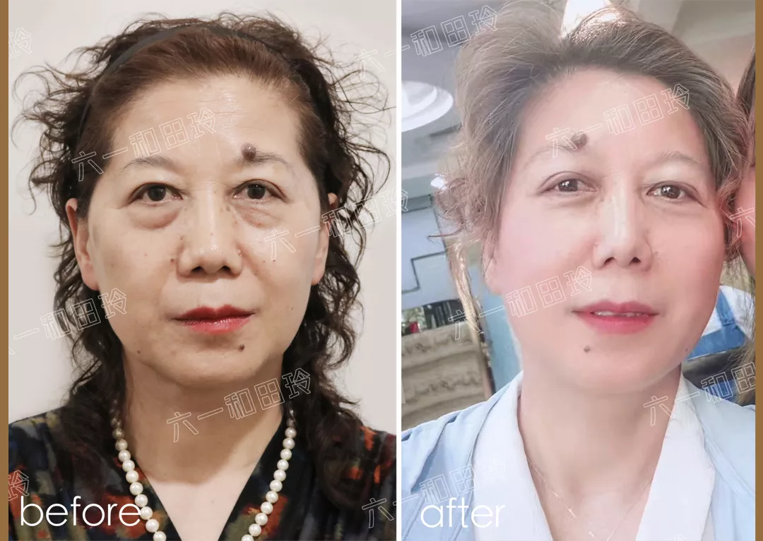 春节送长辈什么礼品好（过年给长辈送礼品送什么合适）