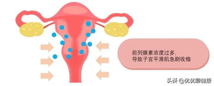 最全痛经知识，感觉这几年都白痛了……
