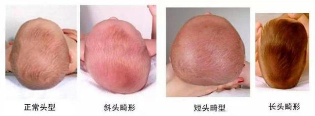 婴儿皱眉头有什么说法(老人说的话不一定对) - 乐宝宝贝