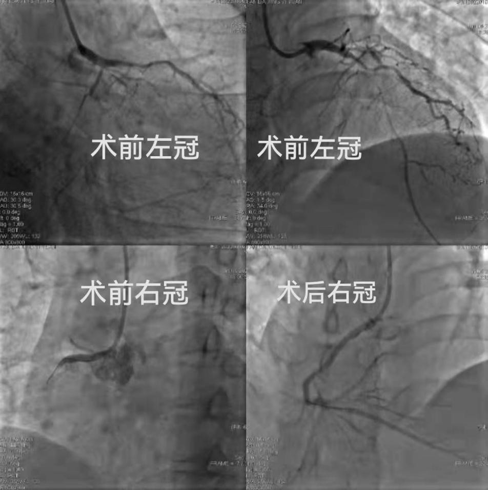 ���÷���������������5G�ٶ�����37���Ĺ�����