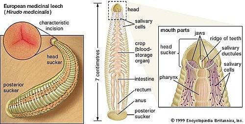 隐私部位也能寄生！女人宫颈口被水蛭寄生，医生：从隐私部位进入