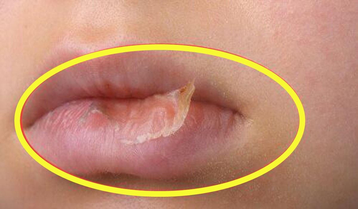 婴儿嘴唇干裂出血怎么办(冬季) - 乐宝宝贝