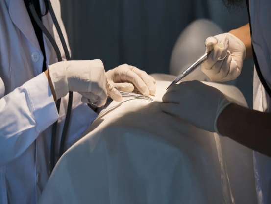 计生女人结扎痛叫图片(节育环不取出来) - 赤虎壹号