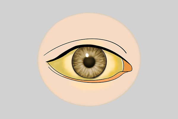 不起眼的坏习惯，正在侵害你的眼睛，Nature：视力越差，衰老越快