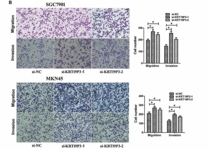 因细胞迁移和侵袭图部分重叠，山东大学发表的高分sci论文被质疑