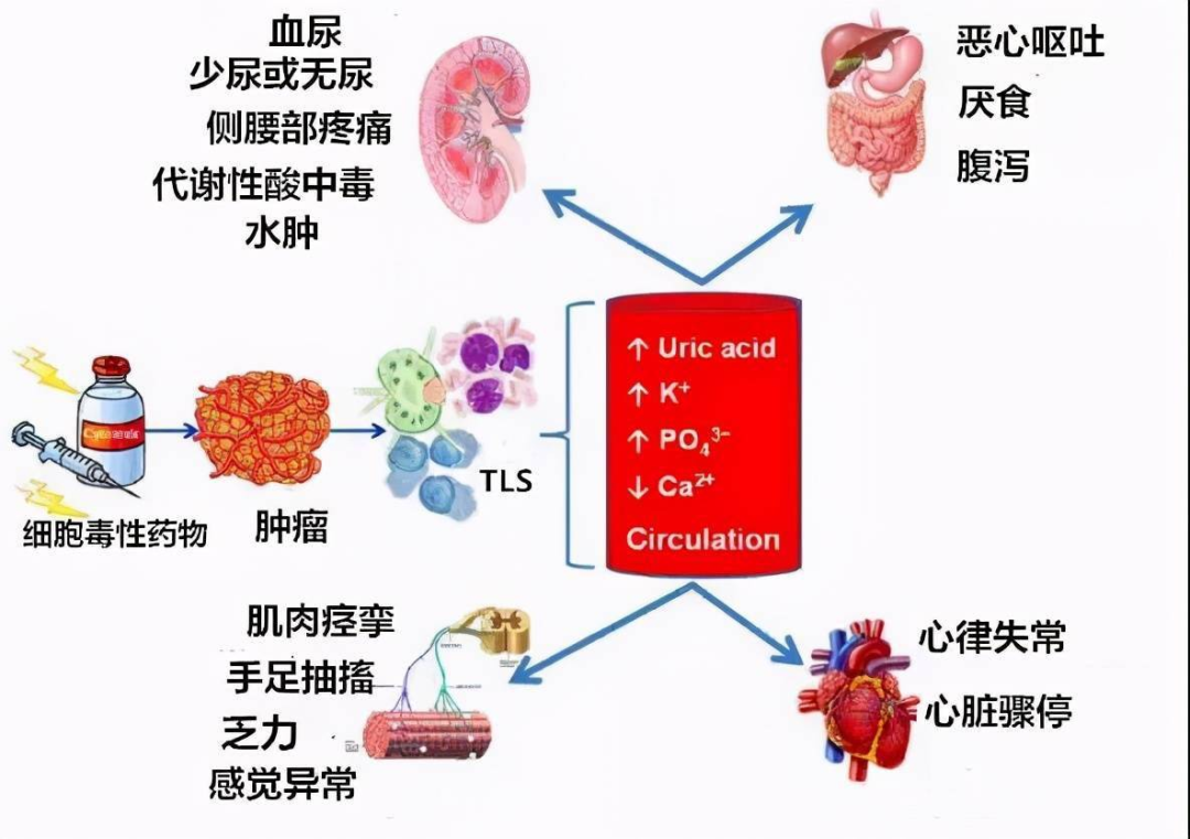 比肿瘤本身更危险！出现这些症状可能是致命急症