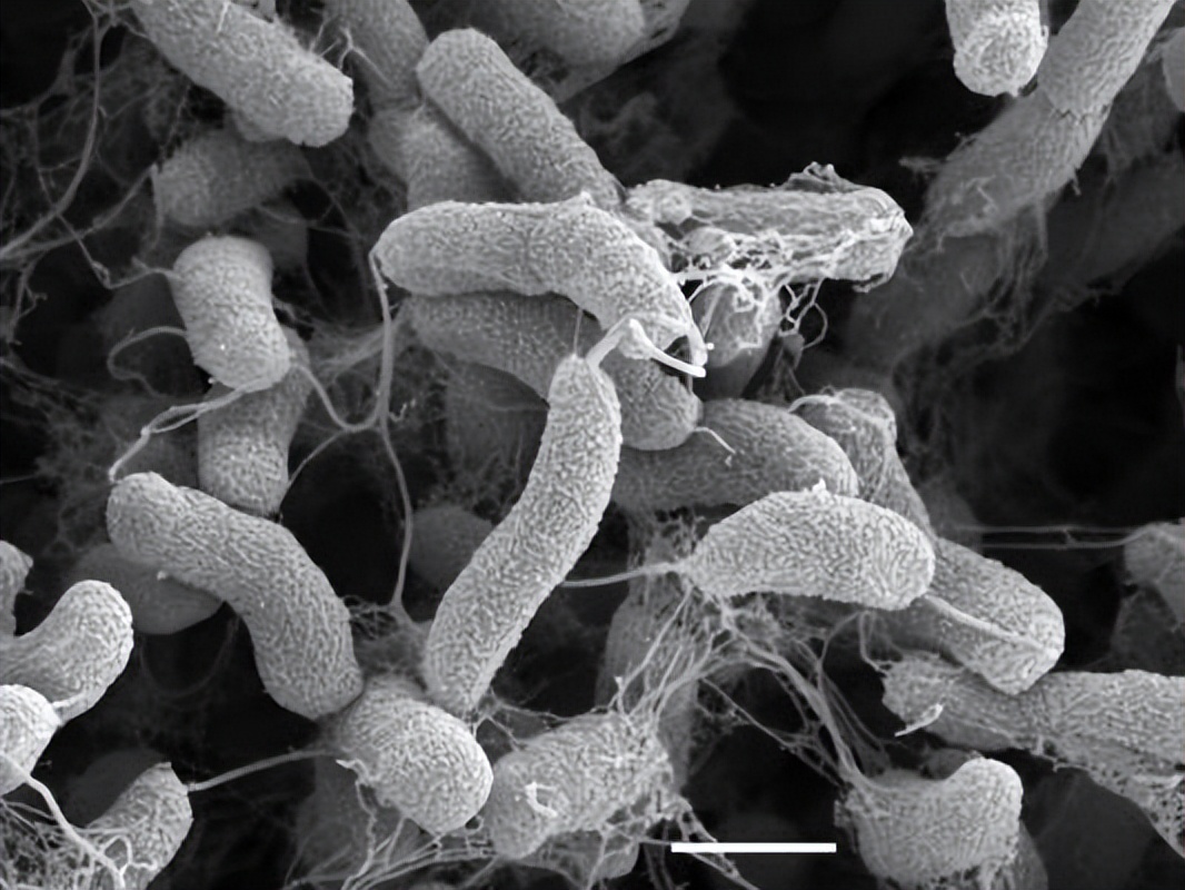 中国甲类传染病目前仅两种:鼠疫和霍乱.