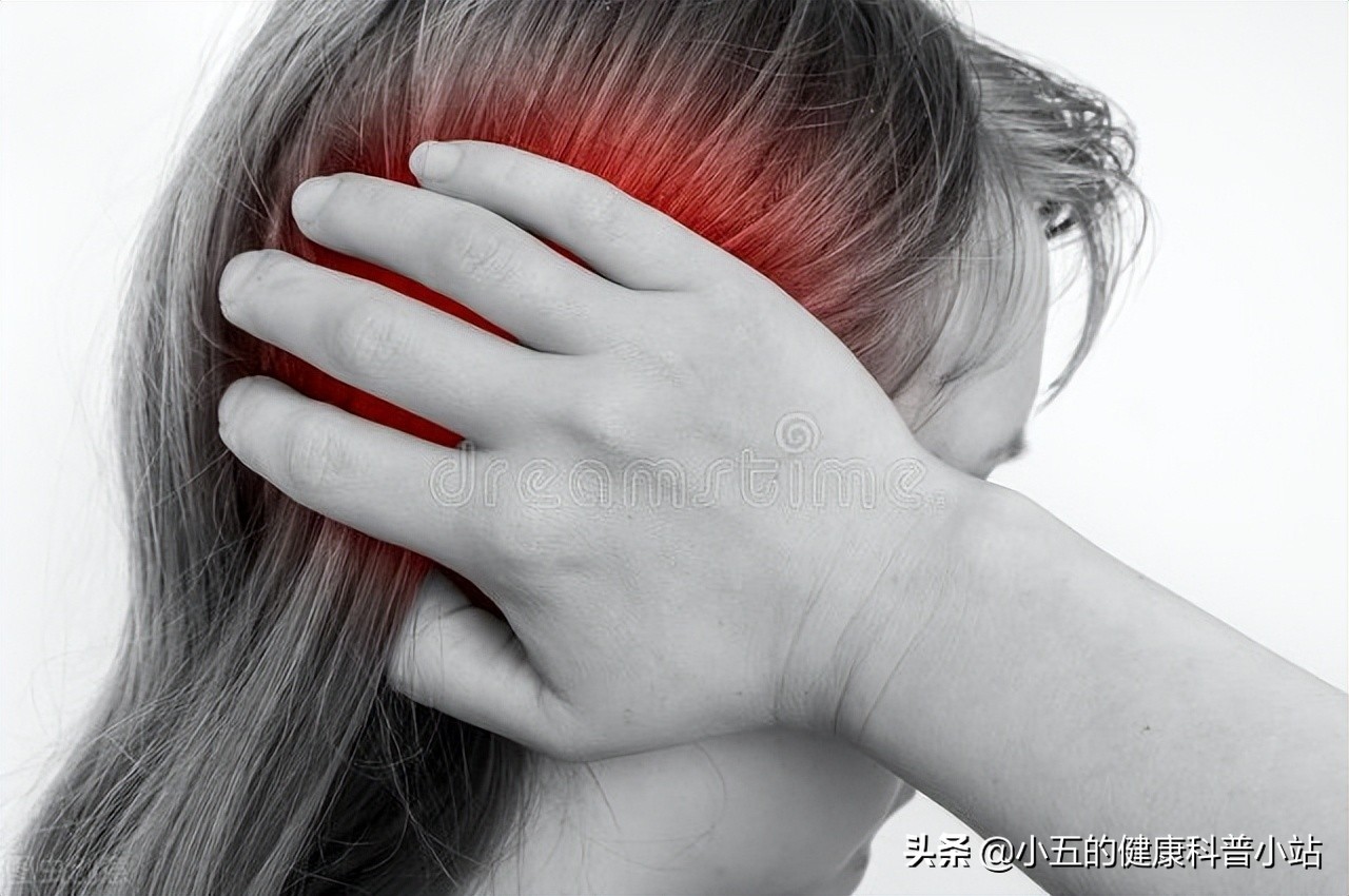 卡马西平是临床治疗三叉神经痛,癫痫的常用药,科学使用注意5点