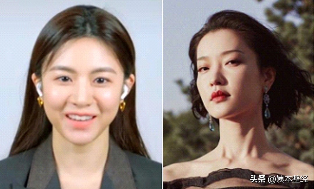 三个显土的长相特征，你中了几个？