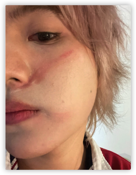 25岁男星被指控打人！直接拿碗砸向好友，受害者脸上伤痕令人后怕