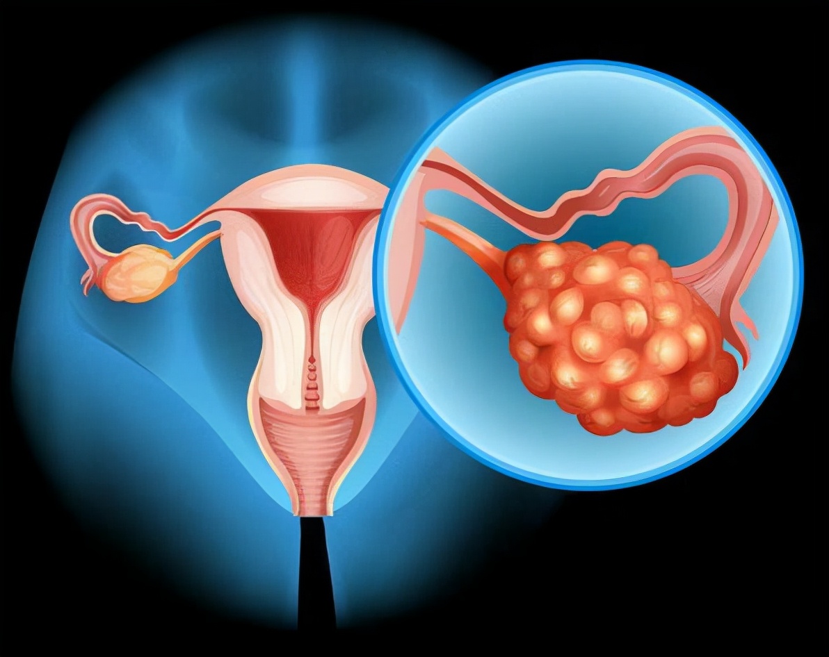 为什么有的女生体毛浓密，而有的却很光滑？这两类人哪种更健康？