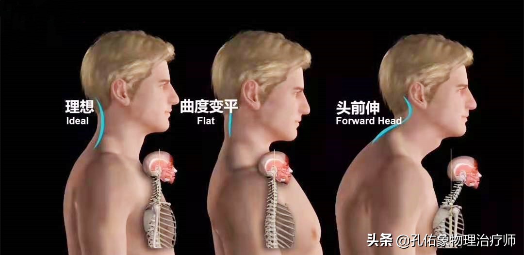 手指麻、肩胛骨疼痛，是怎么回事？出现这4个症状是颈椎发出信号