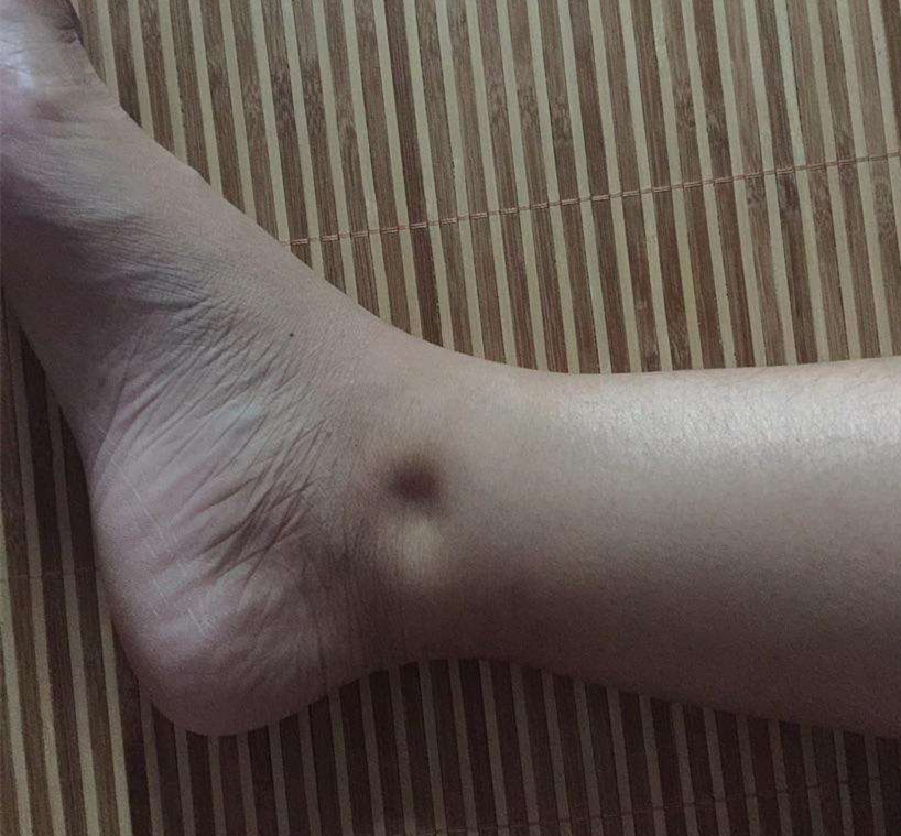 肾好不好可以看看脚，6表现说明肾可能异常，做好3件事，养好肾