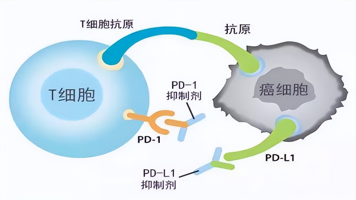 重大突破！首个国产“泛癌种”PD-1上市，覆盖肺癌胃癌等高发癌种