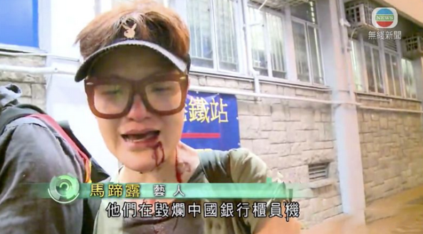 TVB“四大丑女”，两位终生未婚，一位被打却让人心疼