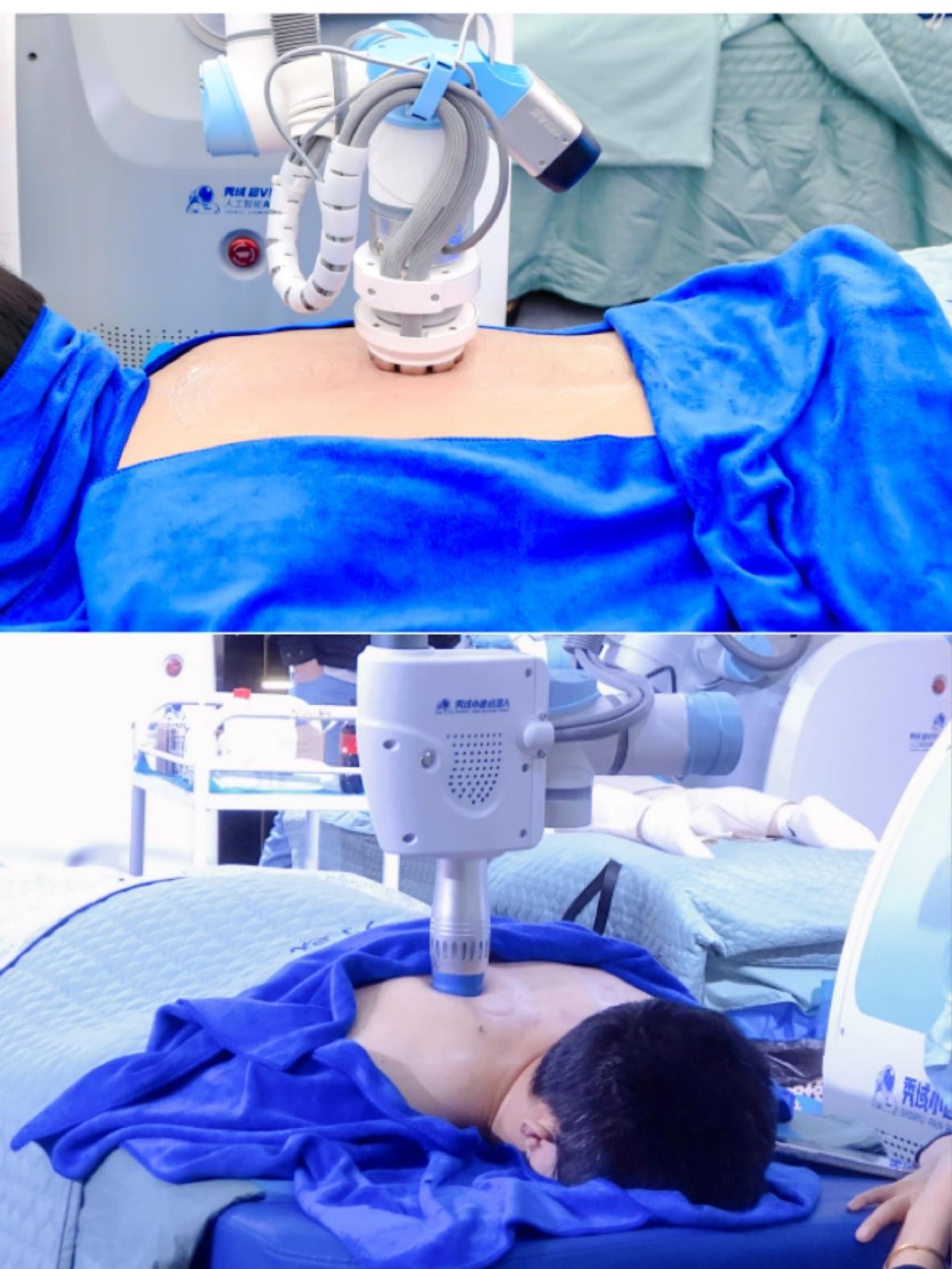 肩周炎到底是怎么回事？三分钟解析清楚