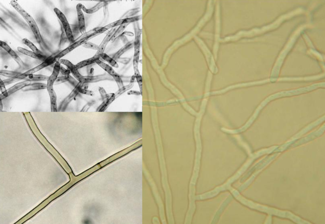 酵素农业技术：岛本酵素菌肥在真菌病害立枯病防治上的应用