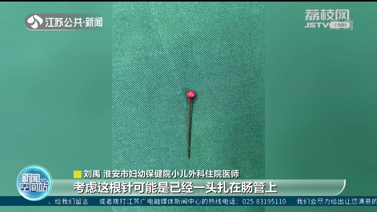 命悬一线！淮安2岁男童吞下3.5厘米钢针 一端扎在肠壁上