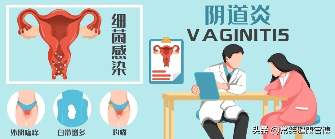 孕期白带检查报告单解读指南：如何正确查看与理解各项指标