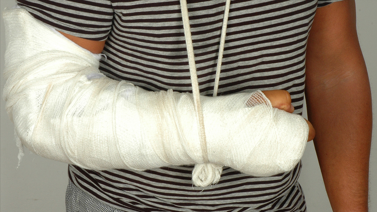 老年人摔倒,桡骨远端骨折该如何治疗?