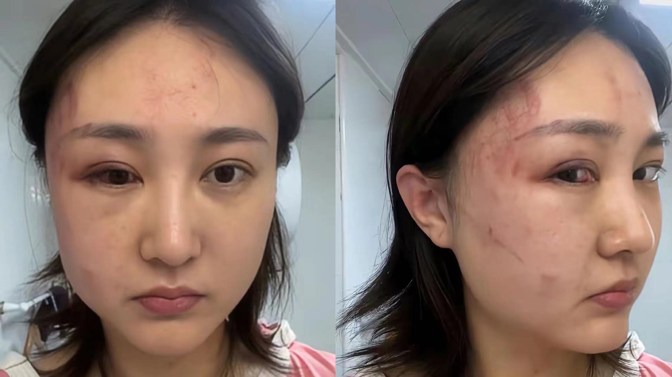 34岁女星被家暴,徐大宝:我想活着