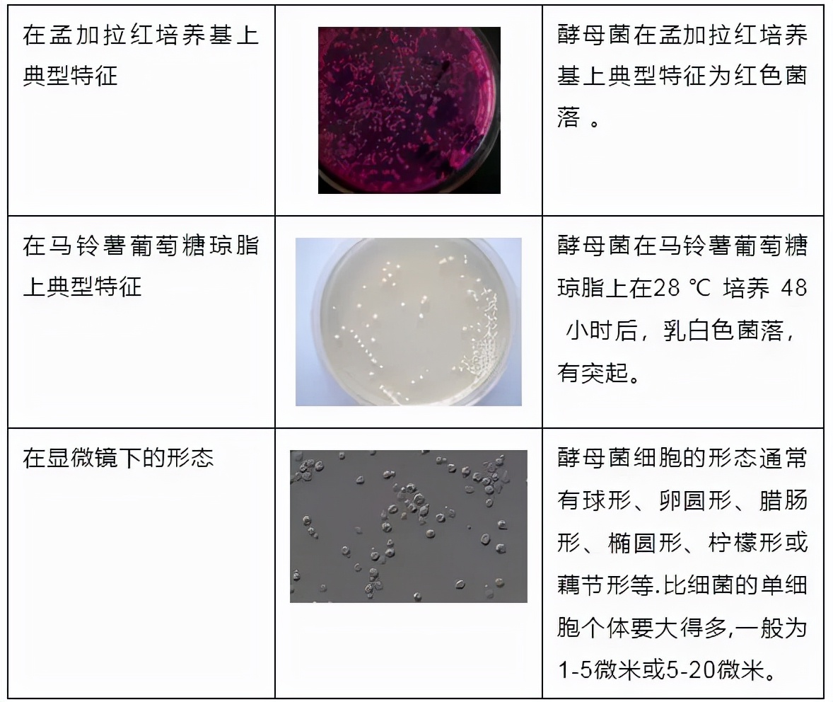 「匯總」各種微生物菌落圖，您都分得清嗎？