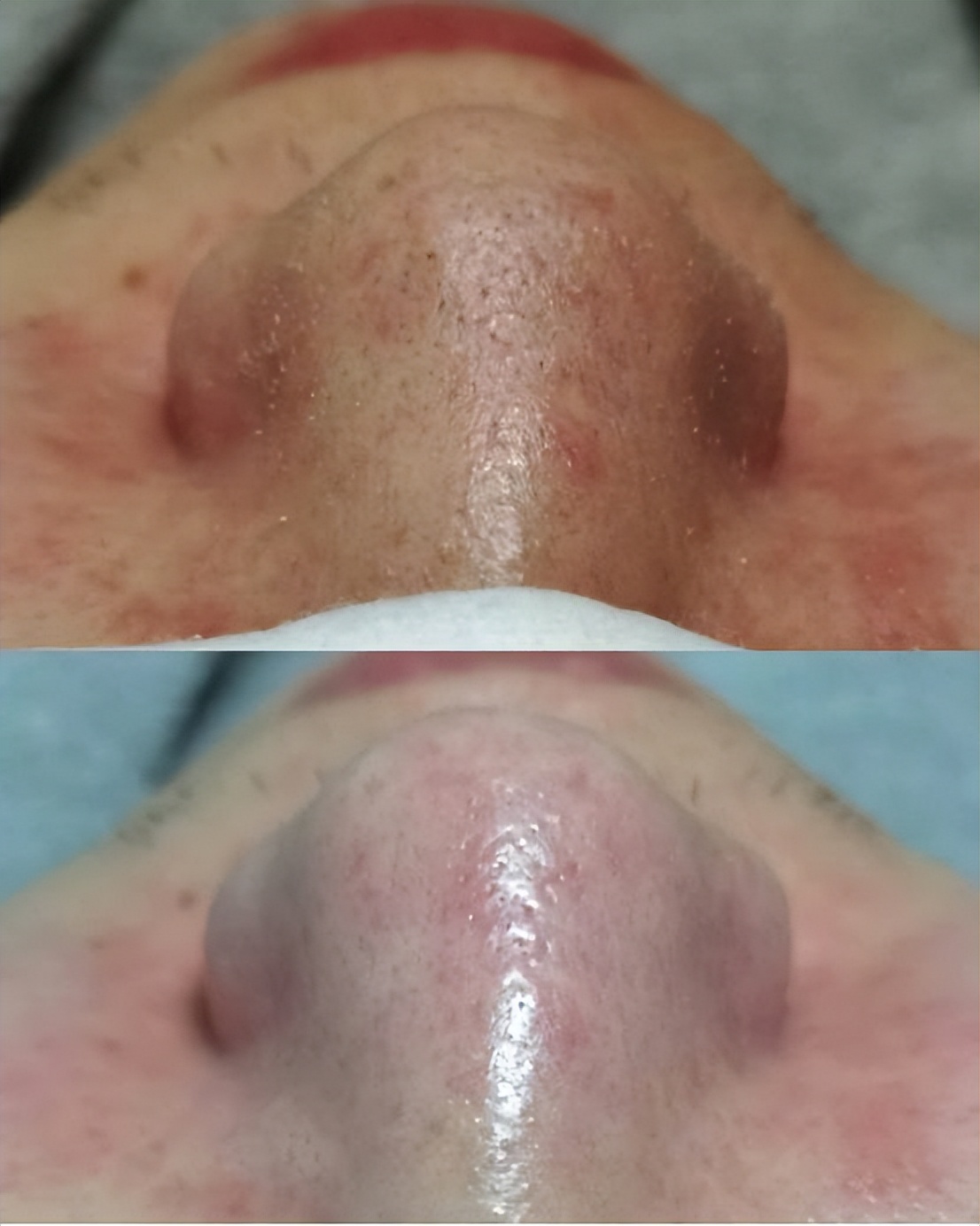 為什么上完粉底液以后，鼻子上有很多白點(diǎn)點(diǎn)？