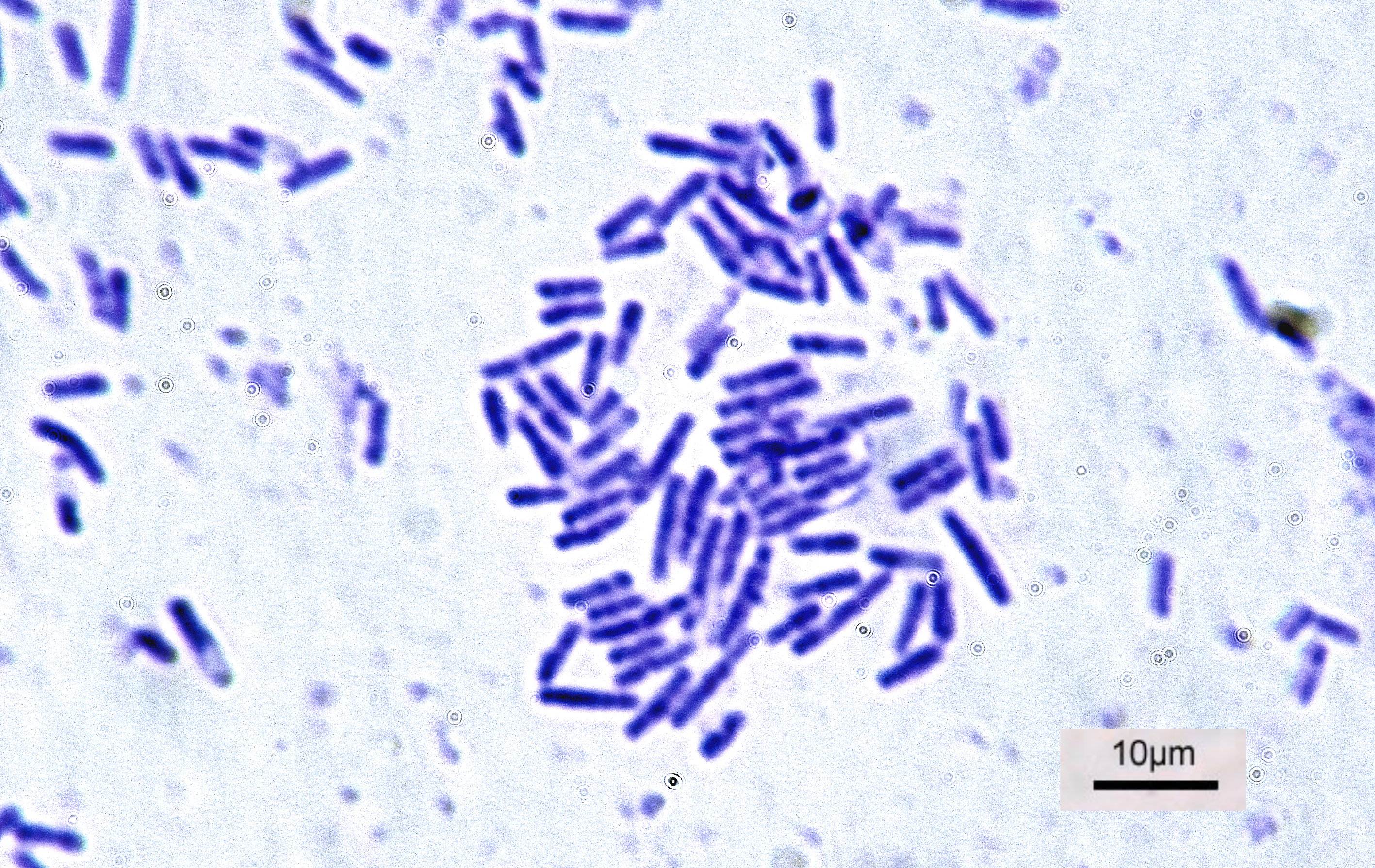 为了永生，科学家给自己注射350万年前的细菌，现在如何了？