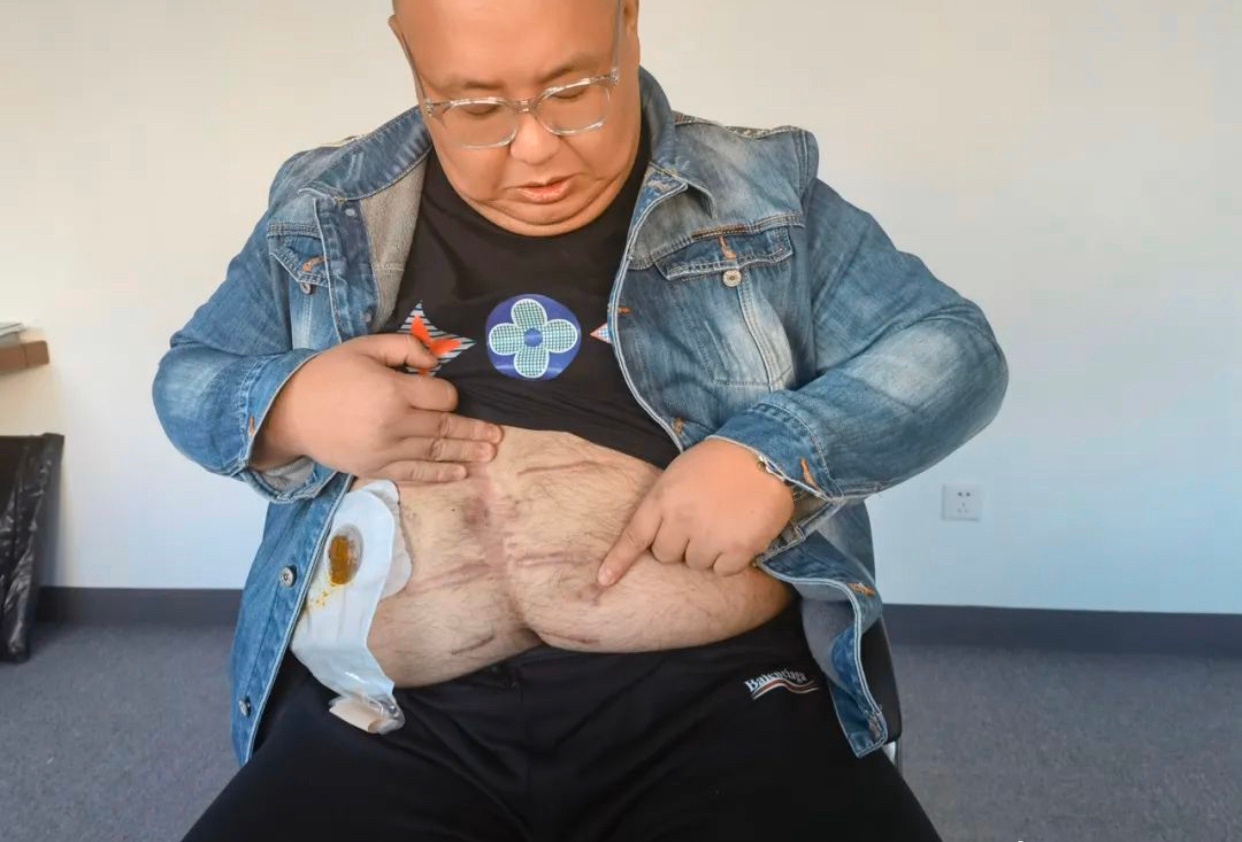 南京胖哥談打人事件：男的也經不起這樣暴打，無需道德綁架圍觀者