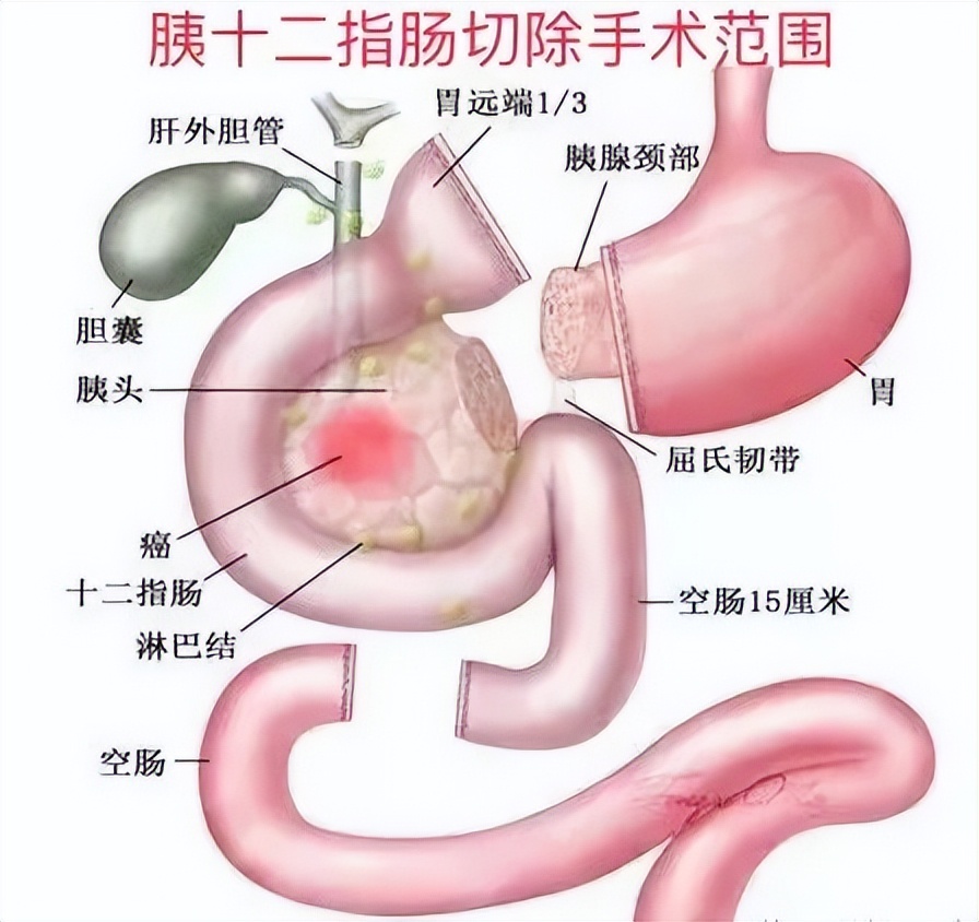 不惧“死亡之吻”，勇攀技术巅峰