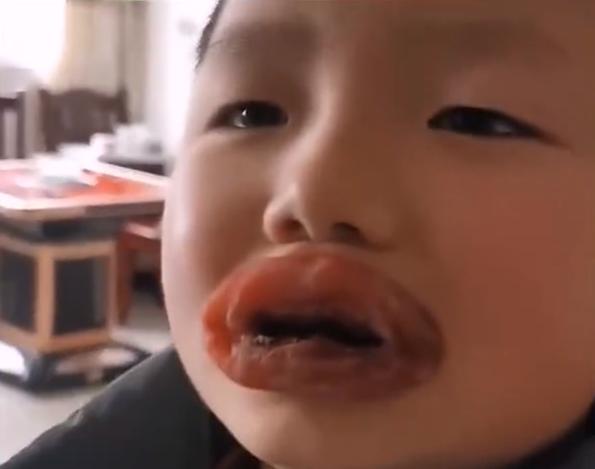 其实小朋友都是这个样子的,家长的劝告不听,只有自己吃了亏以后才会长