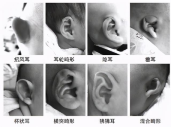 耳朵的结构图,耳朵的结构图解大全