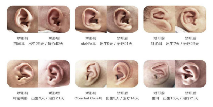耳朵的结构图,耳朵的结构图解大全