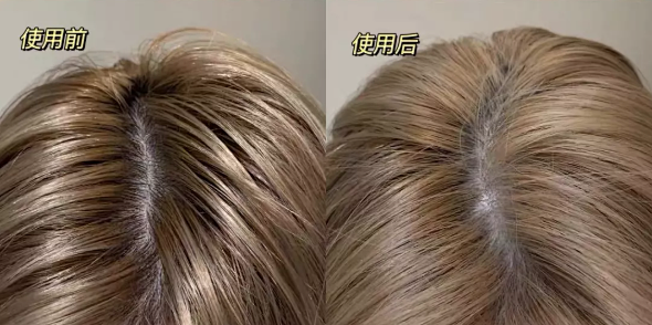 8秒轻松get空气感蓬松发质！寒冷冬天再也不怕油头了