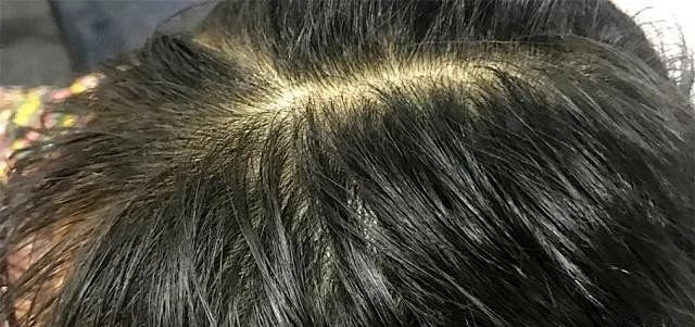 8秒轻松get空气感蓬松发质！寒冷冬天再也不怕油头了