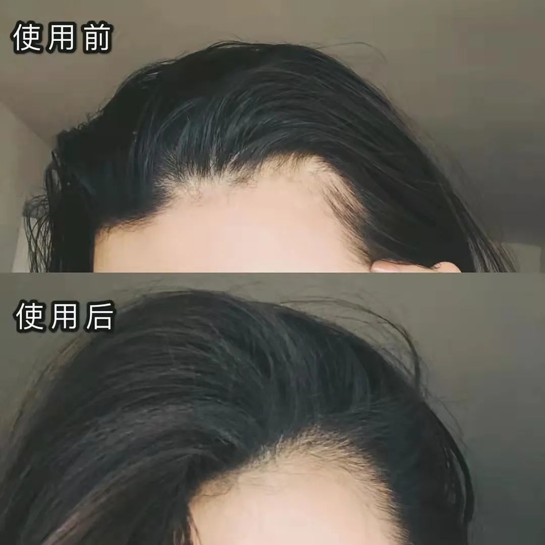 8秒轻松get空气感蓬松发质！寒冷冬天再也不怕油头了