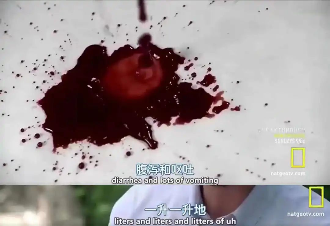 埃博拉病毒僵尸埃博拉病毒僵尸咬人