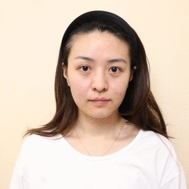 小茂专家团特别版｜雅诗兰黛黑松露眼霜