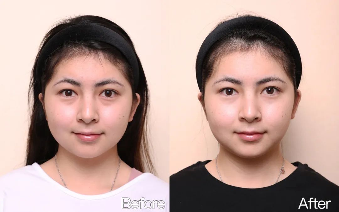 小茂专家团特别版｜雅诗兰黛黑松露眼霜