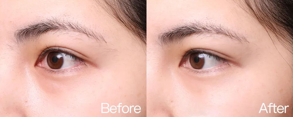 小茂专家团特别版｜雅诗兰黛黑松露眼霜