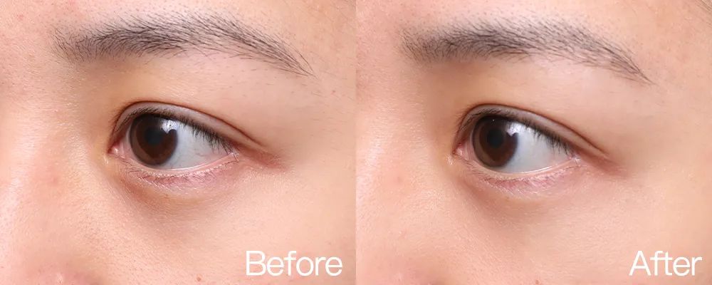 小茂专家团特别版｜雅诗兰黛黑松露眼霜