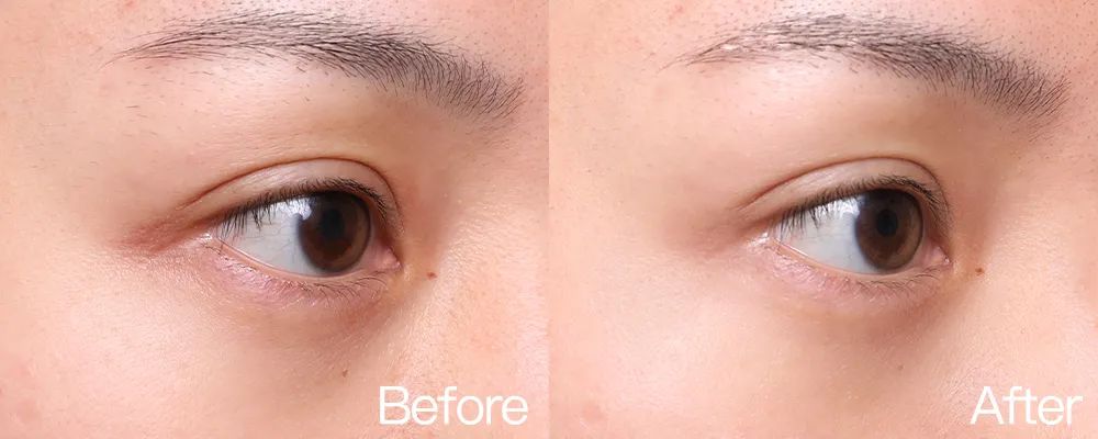 小茂专家团特别版｜雅诗兰黛黑松露眼霜